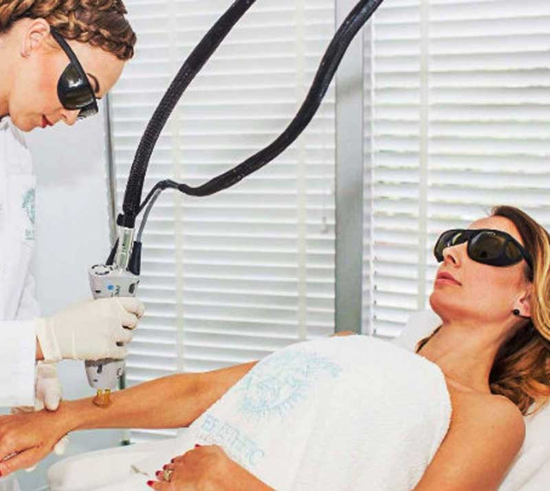 Merit Laser Services