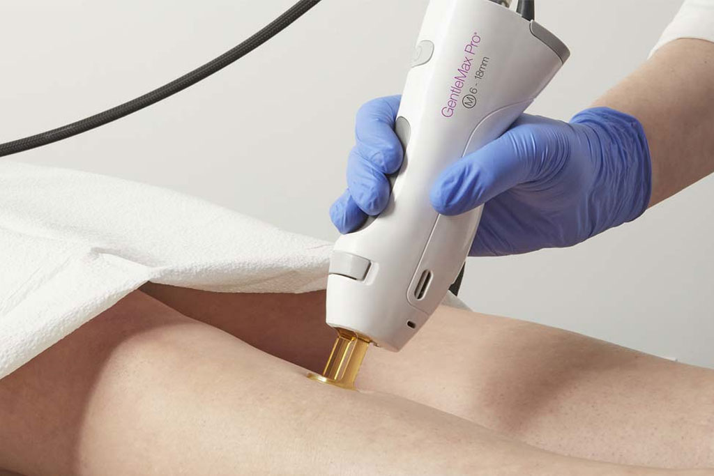 Merit Laser Services