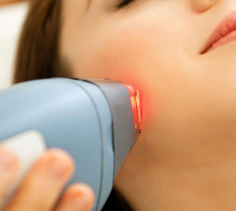 Merit Laser Services