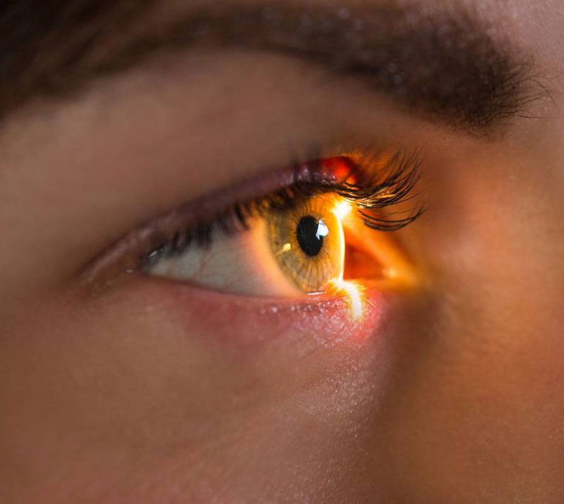 Merit Laser Services