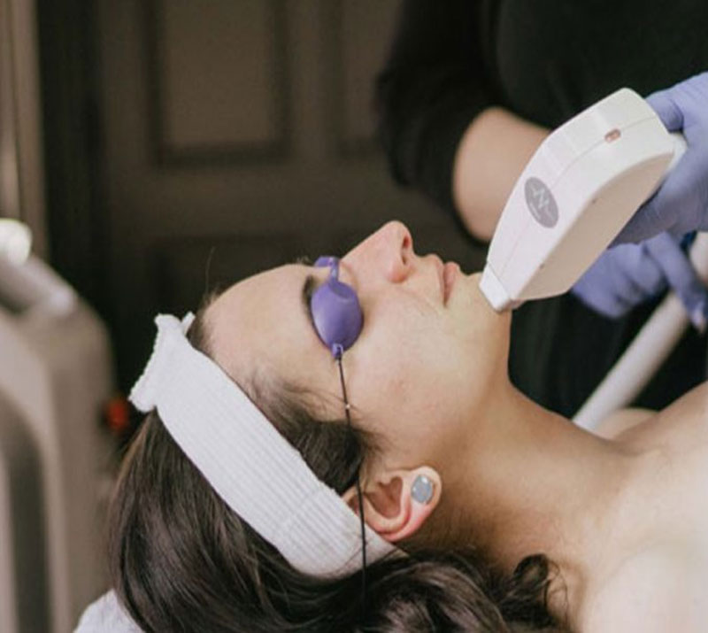 Merit Laser Services